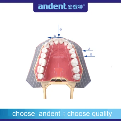 Dental Transparent Guide Plate of Teeth