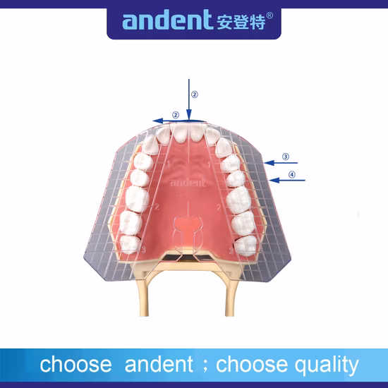 Dental Transparent Guide Plate of Teeth